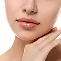 Relleno de Líneas Sobre el Labio (Smoke)