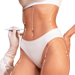 Liposuction Estetiği