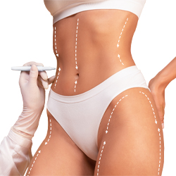 Liposuction Aesthetics