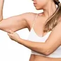 Arm Liposuction